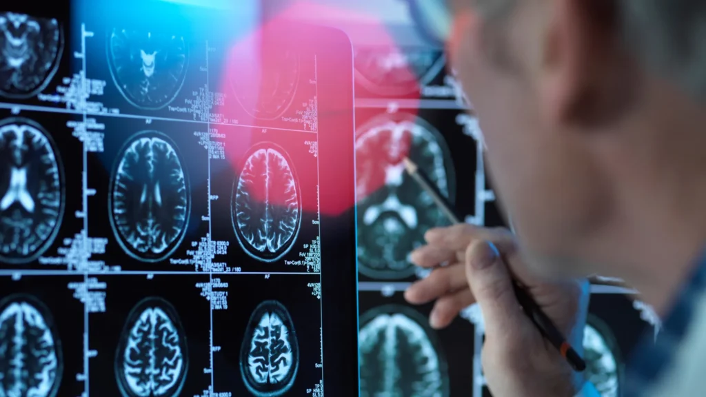 HEMPEARTH - Psychedelics Create New Brain Cells 4 Main Image Psychedelic Drug Market Risk Management