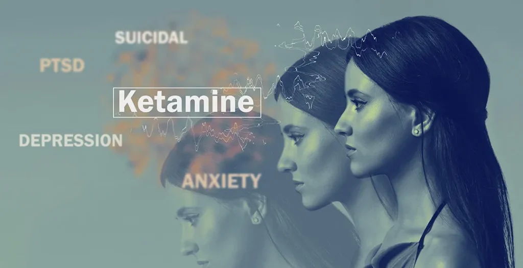 Ketamine MaxWell Clinic