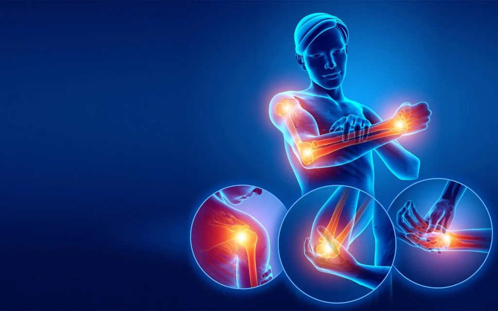 HEMPEARTH - The Benefits Of Ketamine 4 pain management arm joints